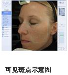 VISIA�沿�D������x�aƷ��B