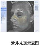 VISIA�沿�D������x�aƷ��B